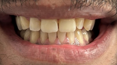 patient after treatment