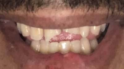 patient before treatment